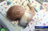 Судебное заседание по делу об ампутации руки младенцу перенесено